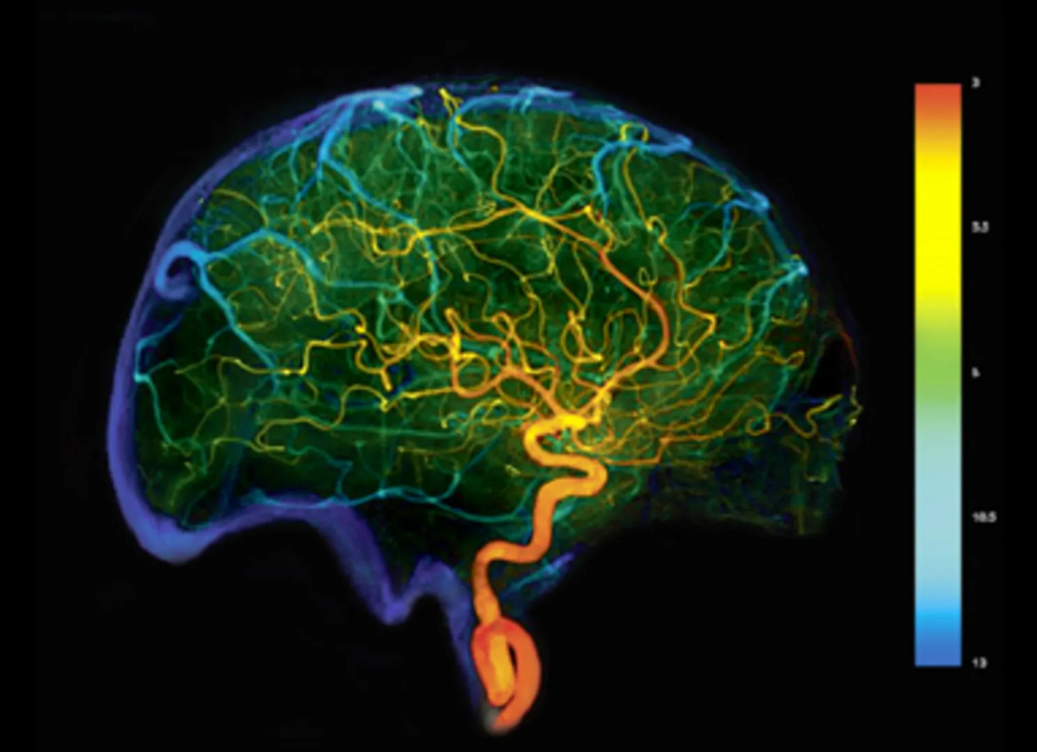 neuro